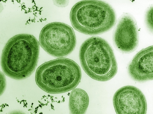 Cianobacteria Prochlorococcus marinus. Wikimedia Commons / Luke Thompson from Chisholm Lab and Nikki Watson from Whitehead, MIT